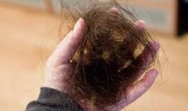 خبراء يكشفون النقاب عن 5 أسباب "مفاجئة" تجعل الشعر يتساقط