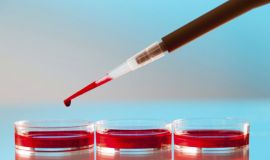 لأول مرة في العالم.. نقل دم للبشر تم تصنيعه في المختبر