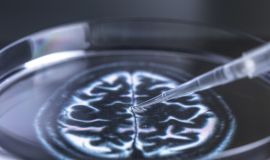 علماء ينمون أنسجة مترابطة بشكل يشبه الدماغ البشري في المختبر